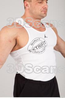 Singlet texture of Gene 0008